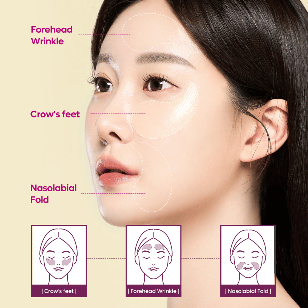 Modello con patch per occhi posizionati su zampe di gallina, fronte e linee nasolabiali che mostra come Dr. Melaxin Cemenrete Calcium Volume Eye Patch possa essere utilizzato per rughe e perdita di volume.