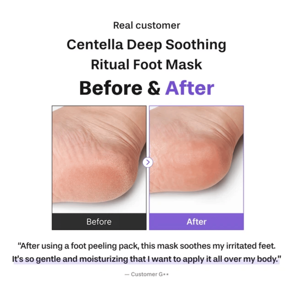 6. Baren Centella Deep Soothing Ritual Foot Mask – immagine prima e dopo che mostra un tallone più morbido e più idratato dopo l’uso