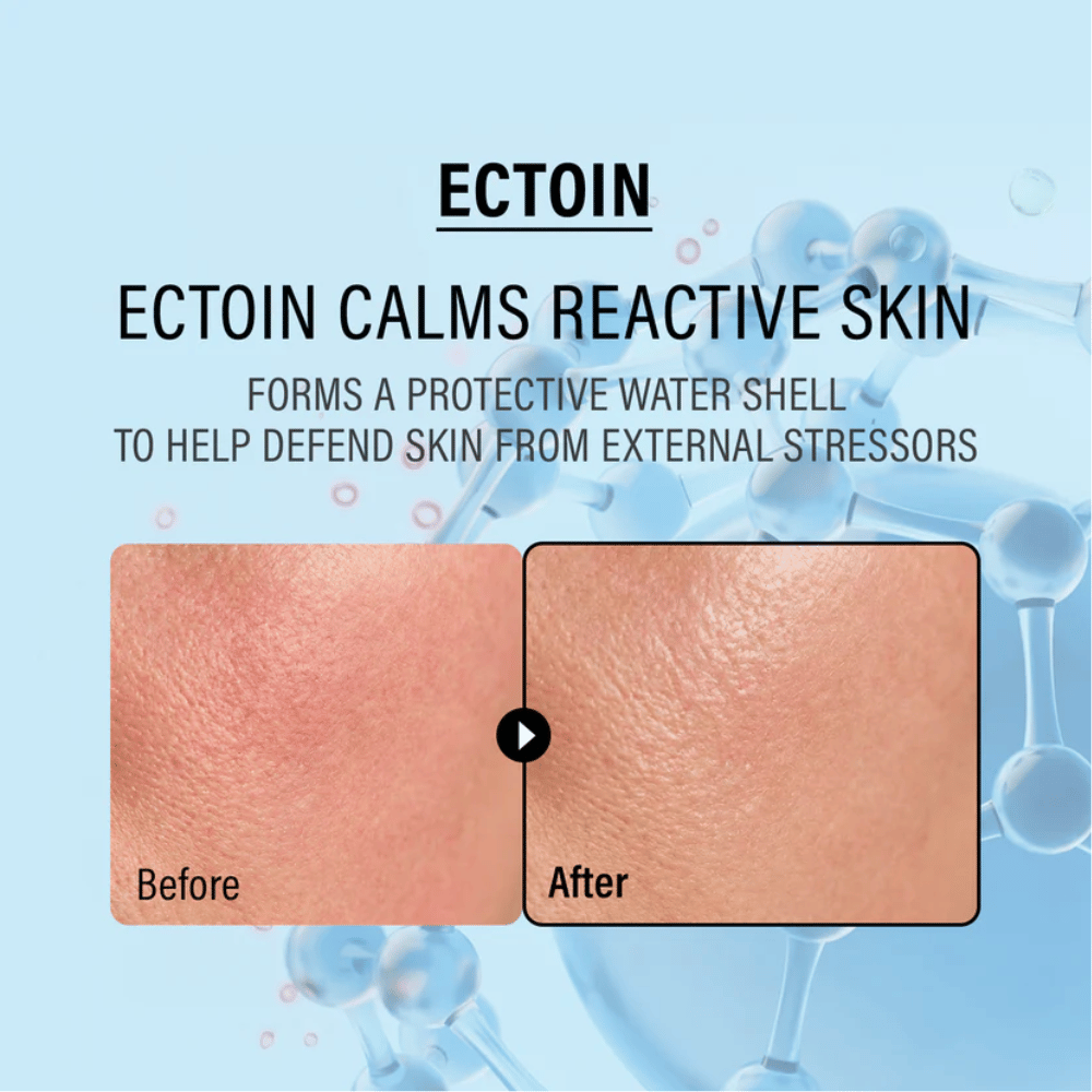 EPII Double Up Cream con ectoina che lenisce la pelle sensibile, protegge dalle aggressioni esterne e rafforza la barriera naturale della pelle.