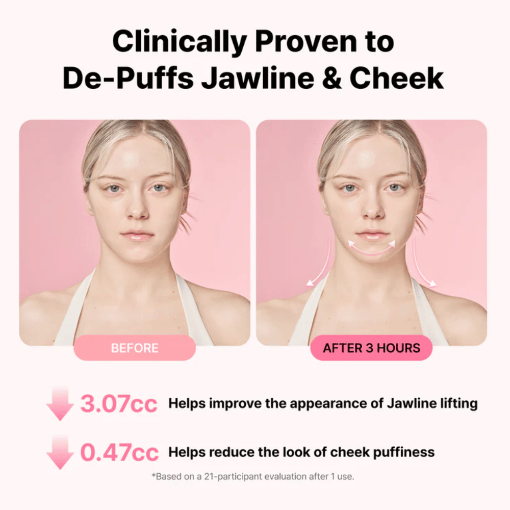 Immagine prima e dopo che illustra un aspetto migliorato della linea mandibolare e una riduzione del gonfiore dopo l'uso di RETURNITY Ear Therapy Acupressure Patch per tre ore.