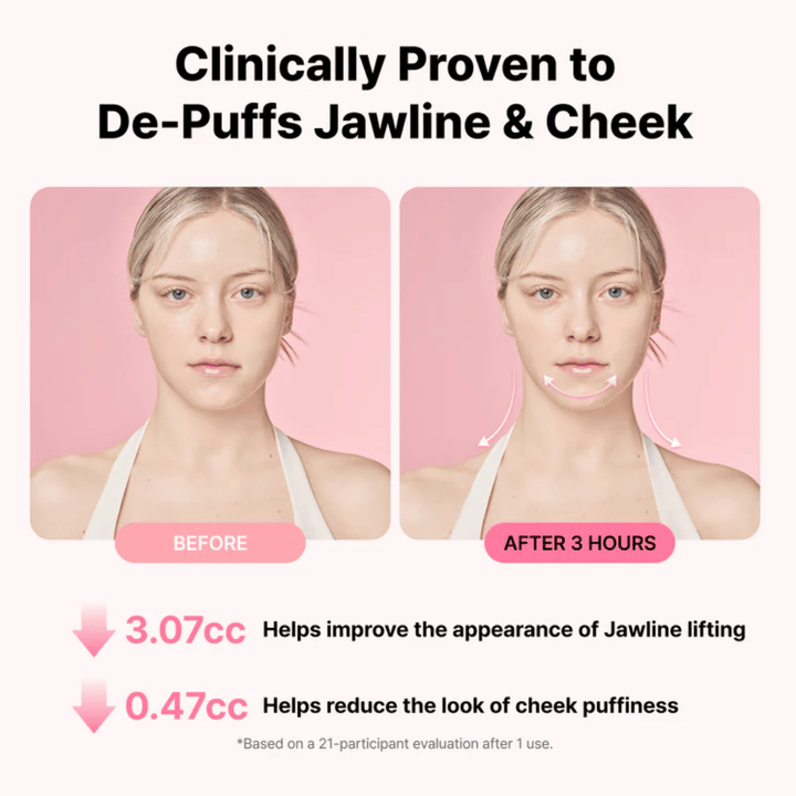Immagine prima e dopo che illustra un aspetto migliorato della linea mandibolare e una riduzione del gonfiore dopo l'uso di RETURNITY Ear Therapy Acupressure Patch per tre ore.
