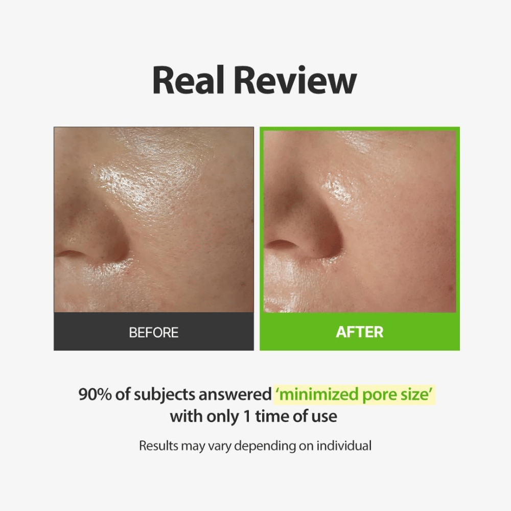 SUNGBOON EDITOR Green Tomato Pore Peeling Jumbo Pad – immagine prima e dopo con focus sui pori visibili