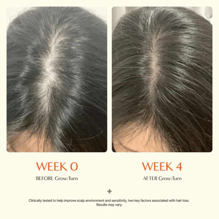 Primo piano del cuoio capelluto prima e dopo 4 settimane – scriminatura dei capelli più definita che appare più folta dopo il trattamento.