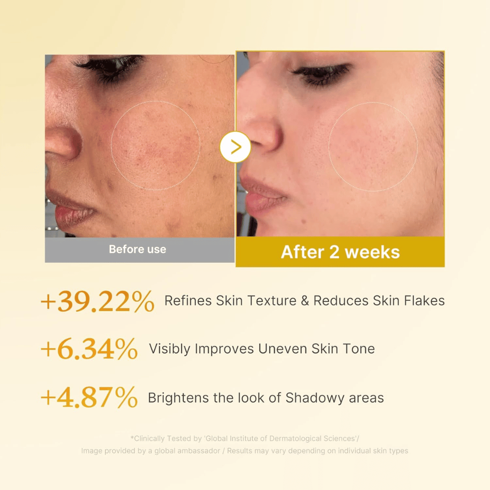 Immagine prima e dopo per Medicube Kojic Acid Turmeric Resurfacing Toner che mostra una texture cutanea migliorata, un incarnato più uniforme e una riduzione delle pellicine secche dopo due settimane di utilizzo.