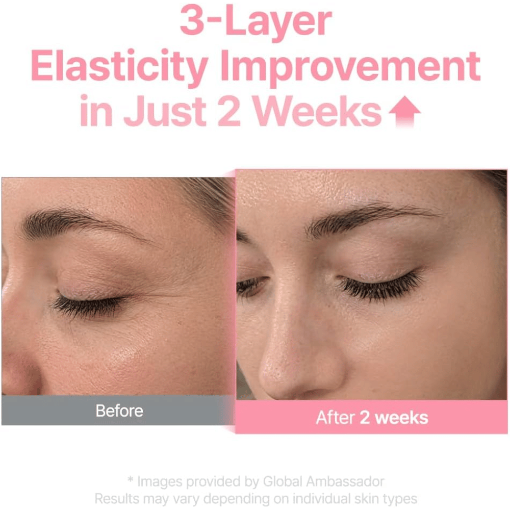 Immagine prima e dopo per Purito Multi PDRN Collagen EGF Serum che mostra una migliore elasticità della pelle dopo due settimane.