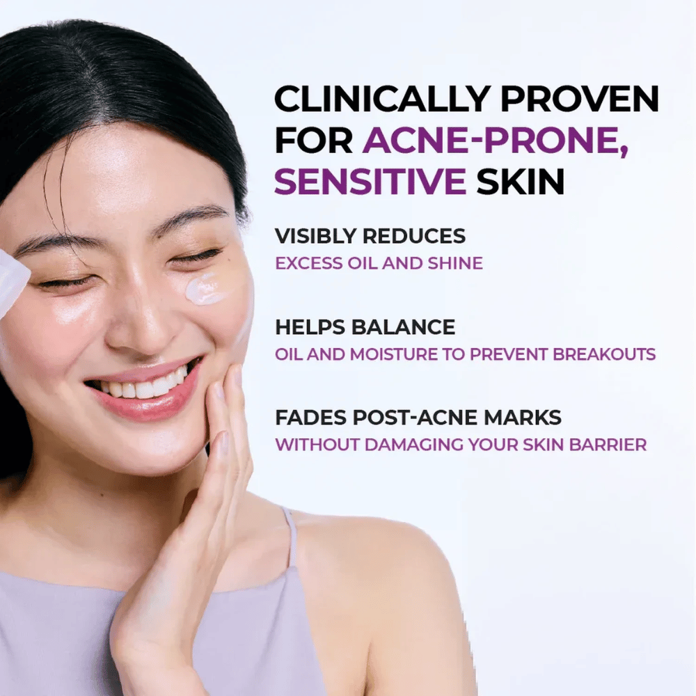 Modella che applica la crema sulla guancia. L'immagine mette in evidenza la capacità del prodotto, clinicamente dimostrata, di ridurre la lucidità, bilanciare i livelli di olio e idratazione della pelle e ridurre la visibilità dei segni post-acne.