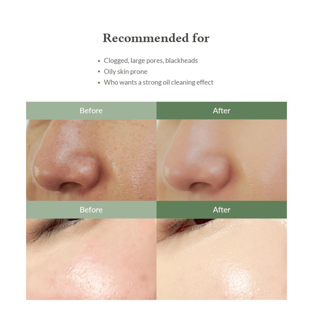 Dr. Althea Premium Quick Step Sebum Cleanser – detergente viso che aiuta a ridurre i punti neri, pulire i pori in profondità e offrire una texture della pelle più uniforme.