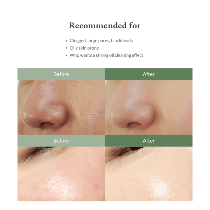 Dr. Althea Premium Quick Step Sebum Cleanser – detergente viso che aiuta a ridurre i punti neri, pulire i pori in profondità e offrire una texture della pelle più uniforme.